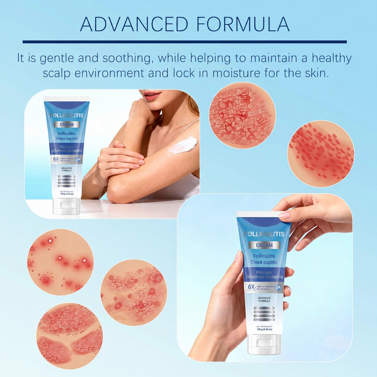 💙Folliculitis Soothing Cream for Folliculitis Scalp Face and Body💙