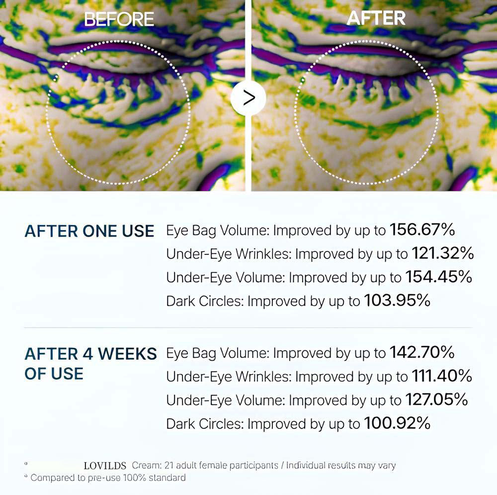 Revitalizing Under Eye Cream | Anti-Aging Moisturizer for Dark Circles, Puffiness & Fine Lines